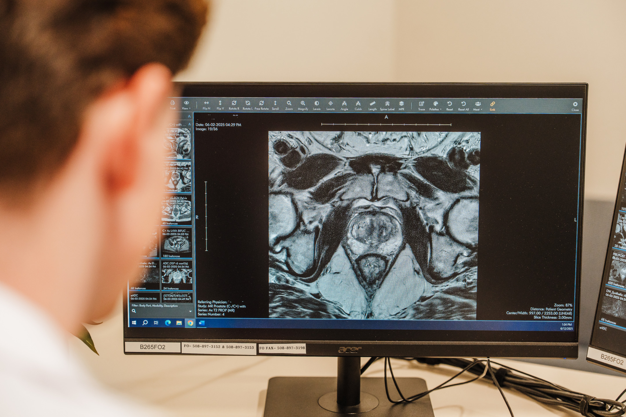 Doctor examining an MRI scan on a computer screen in a medical office setting.
