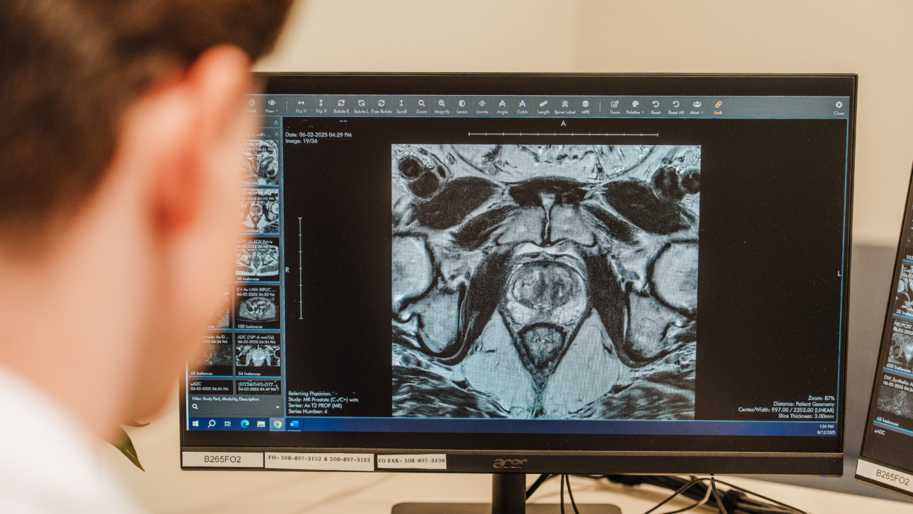 Doctor examining a detailed cross-sectional medical scan on a computer monitor in a clinical setting.