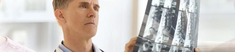 Doctor examining an X-ray closely in a medical office environment